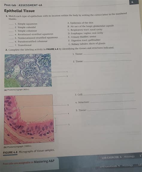 Solved Post Lab Assessment A Epithelial Tissue Match Chegg