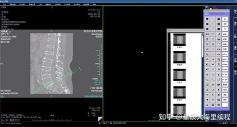 3d医学影像pacs系统 知乎