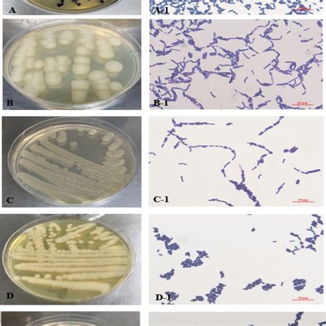 Colonial Morphology And Their Microscopic Image A And A 1 Morphology