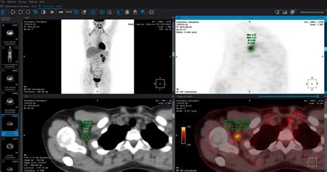 Inobitec Medical Imaging Software For Professionals