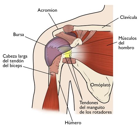 Compresi N Del Hombro Tendinitis Del Manguito Rotador Shoulder