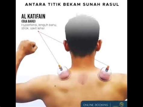 TITIK BEKAM SUNNAH RASULULLAH YouTube