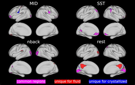 Brain maps for top 10 brain regions in predicting fluid and ...