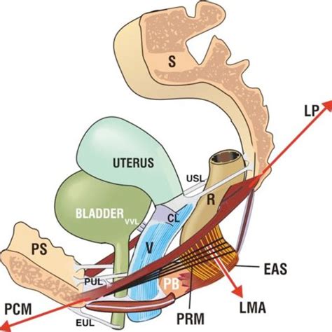 Uterosacral Usl And Cardinal Cl Ligaments Are Related Both Stretch