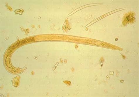 Strongyloides Stercoralis Egg