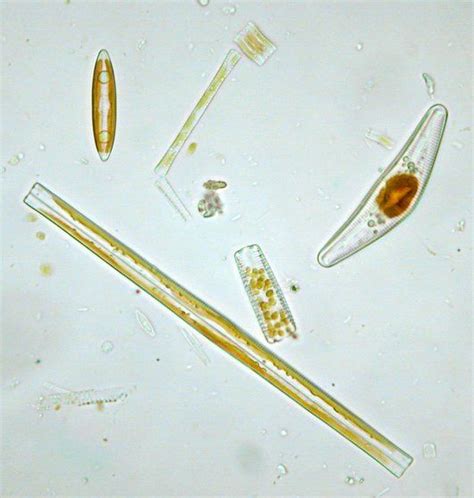 Microview Living Diatoms | Diatom, Protists, Algae