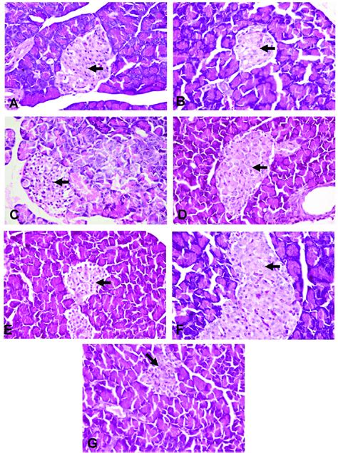 Photomicrographs Of Rats Pancreas Stained With H E X A Normal