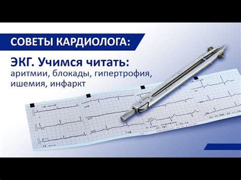 Советы кардиолога: ЭКГ. Учимся читать - YouTube
