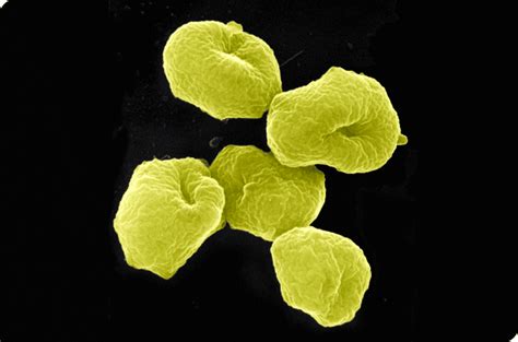 Microbiología: Dominio Archaea