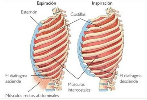 Dolor intercostal asociados a la respiración o esfuerzos hiperpresivos