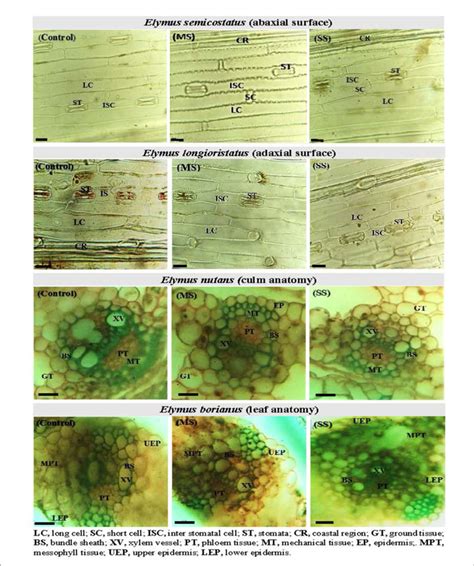 FIGURE Leaf Epidermal Anatomy Abaxial Surface And Adaxial Surface Of