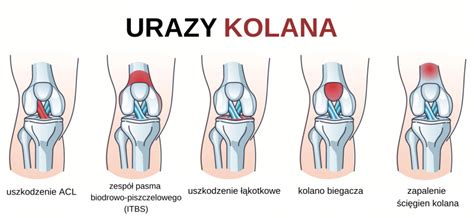 Kolano Biegacza Jak Rozpozna I Leczy To Schorzenie U Sportowc W