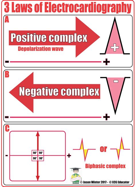 Heart Axis