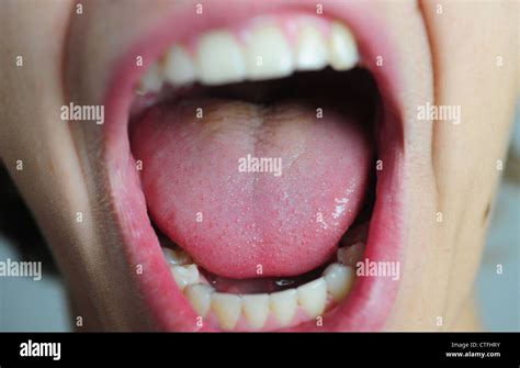 Teenage kids mouth close up teeth lips open yelling mouthes Stock Photo - Alamy