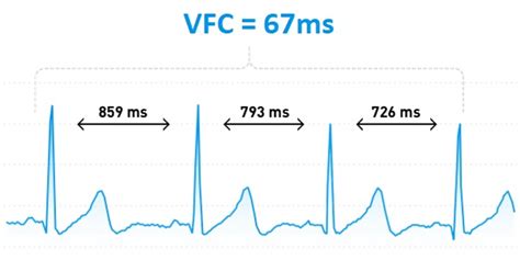 La Variabilit De Fr Quence Cardiaque Pour Sentrainer Jai Enregistr