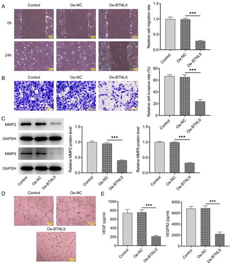 The Role Of Btnl In Os Cell Migration Invasion And Angiogenesis A