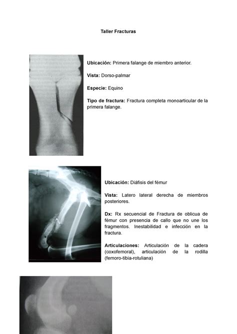 Taller Fracturas Taller Fracturas Ubicación Primera falange de