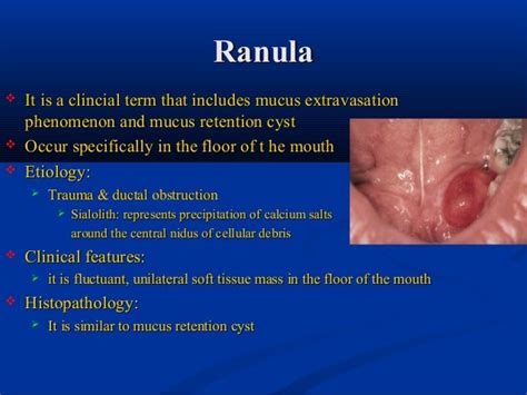 Salivary Gland Pathology