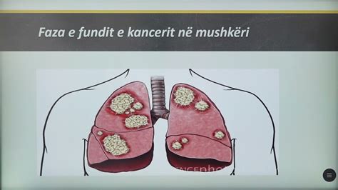 Java E Tremb Dhjet Biologji S Mundjet E Rrug Ve T