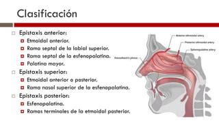 Epistaxis PPT