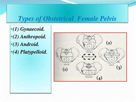 Ppt Pelvis And Sacrum Powerpoint Presentation Id2744161