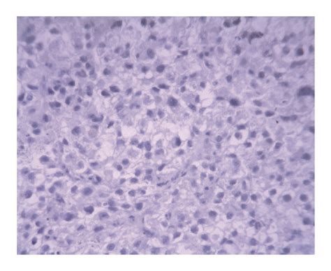 Histopathological Staining Findings A Hande Staining Showing High Download Scientific Diagram