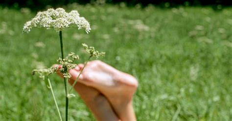 Wild Parsnip Burns Symptoms Treatment And Prevention