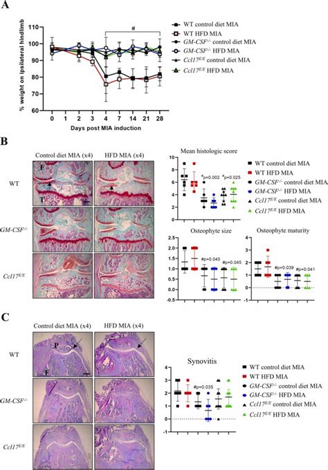 The GM CSF CCL17 Pathway In Obesity Associated Osteoarthritic Pain And