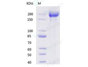 Recombinant Human Ly Cd Protein H H Sino Biological