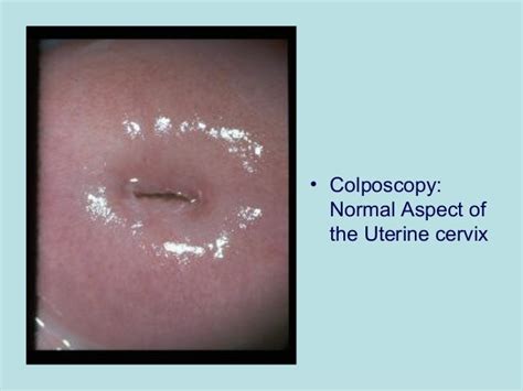 Pathology Of Cervix