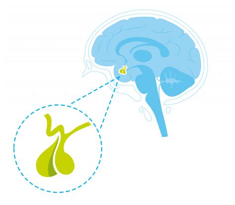 Oorzaken Aandoeningen Aan De Hypofyse Hypofyse Nl
