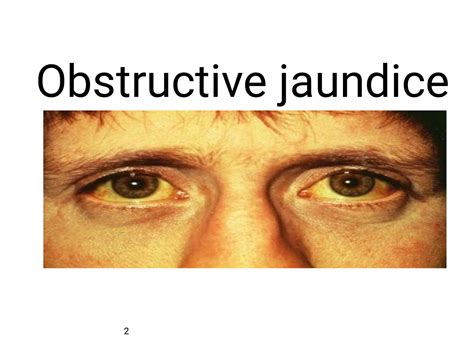 Solution Obstructive Jaundice Reduced Studypool