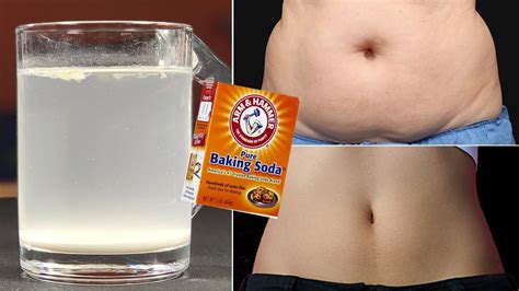 Loss All Your Belly Fat With Baking Soda No Exercise No Diet Youtube