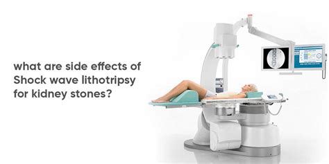 Risks and Side Effects of Shock Wave Lithotripsy for Kidney Stones