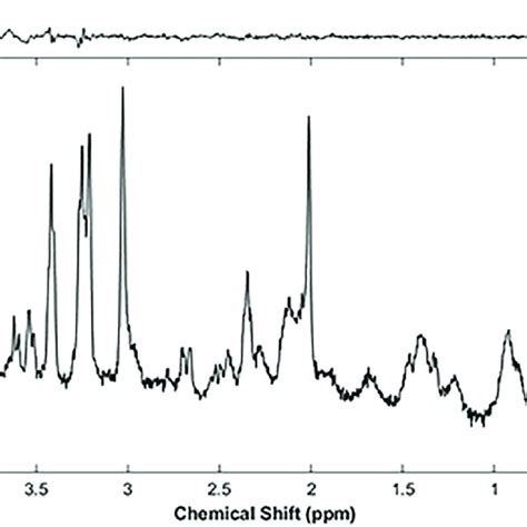 A Representative Single Voxel 1 H MR Spectrum From A PME Mouse Using A