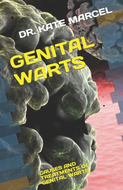 Genital Warts Causes And Treatments Of Genital Warts By Dr Kate