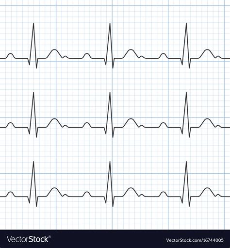 Cardiogram Royalty Free Vector Image - VectorStock