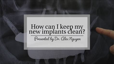 How To Keep Your New Dental Implants Clean Healthy Youtube