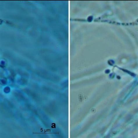 Phase Contrast Microscopy Of Beauveria Bassiana Hc Z1 A And Hc Z2 B Download Scientific