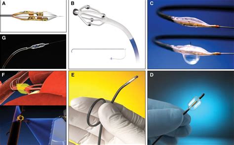 Renal Sympathetic Denervation Therapy For Resistant Hypertension Circulation Cardiovascular