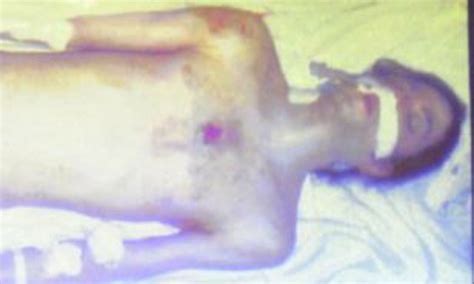 Michael Jackson Autopsy Photo Unedited