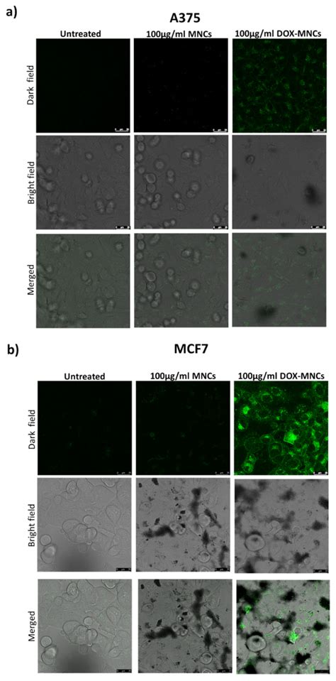 Nanomaterials Free Full Text Smart Magnetic Nanocarriers For Multi