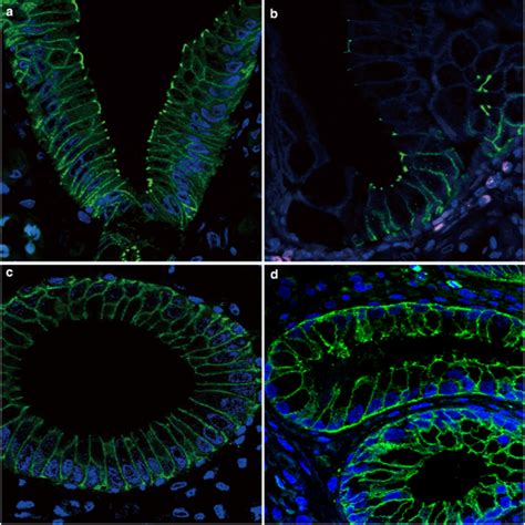 Immunofluorescence Analysis Of Tight Junctions Claudin In The Polyp