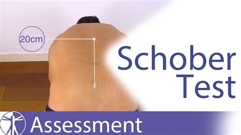 Schober Test