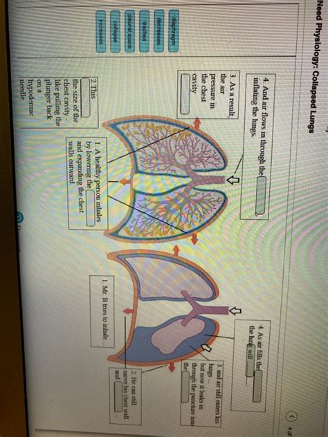 Need Physiology Collapsed Lungs
