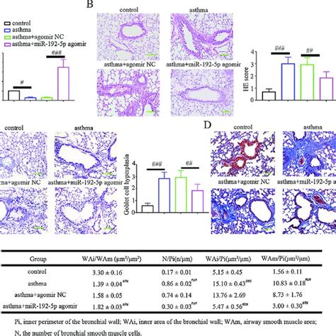 Mir P Suppressed Cell Proliferation And Down Regulated Mmp And