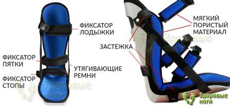 Купить ночной ортез при пяточной шпоре (плантарном фасциите ...