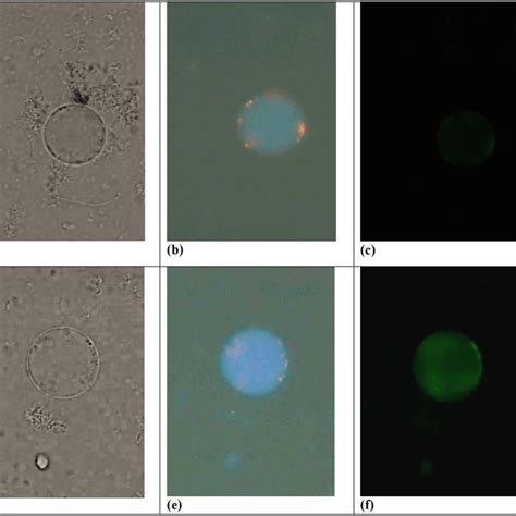 Tem Photographs A C And E Shows Untreated Blastocystis Sp Download Scientific Diagram