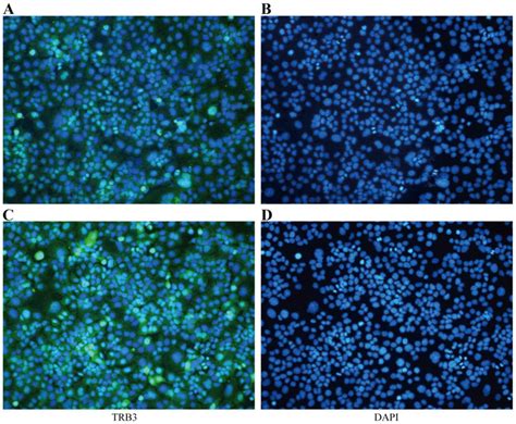 Expression Of Trb3 Promotes Epithelial‑mesenchymal Transition Of Mle‑12 Murine Alveolar Type Ii