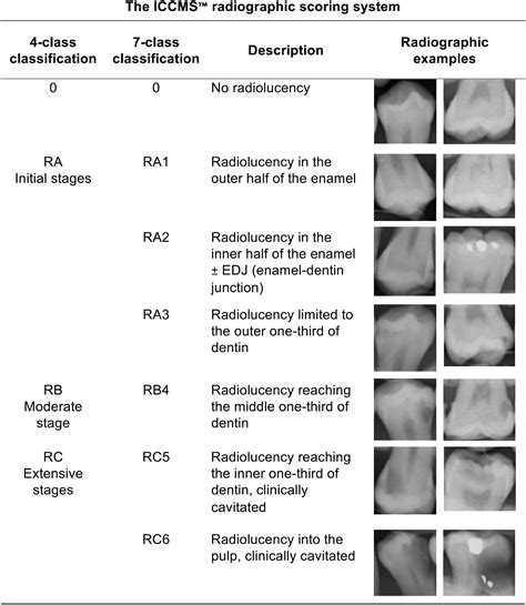 Feasibility Of Deep Learning For Dental Caries Classification In